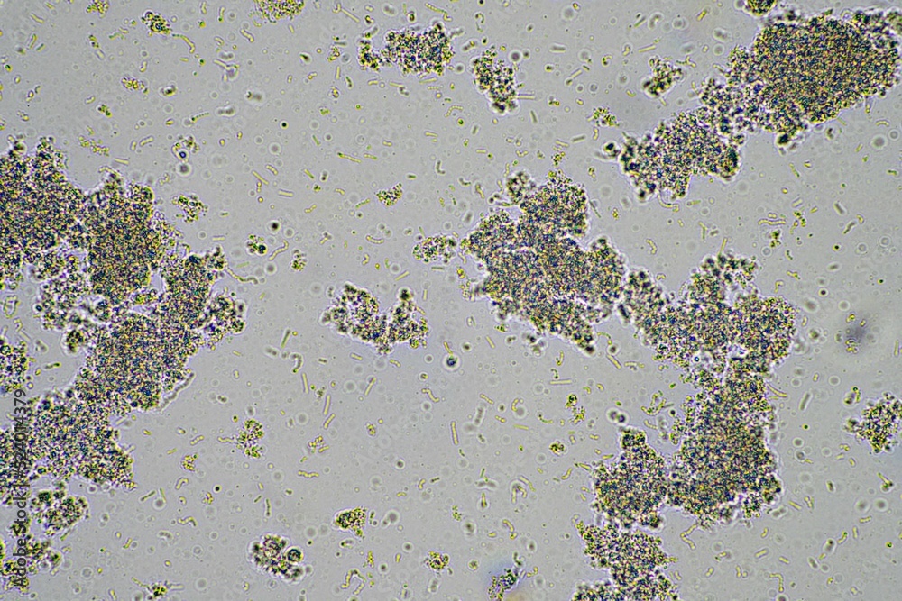 Yogurt under the microscope. Looking at lactobacillus bacteria in a