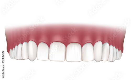 Realistic correct human upper jaw. Human jaw isolated on white background. Dental care concept.