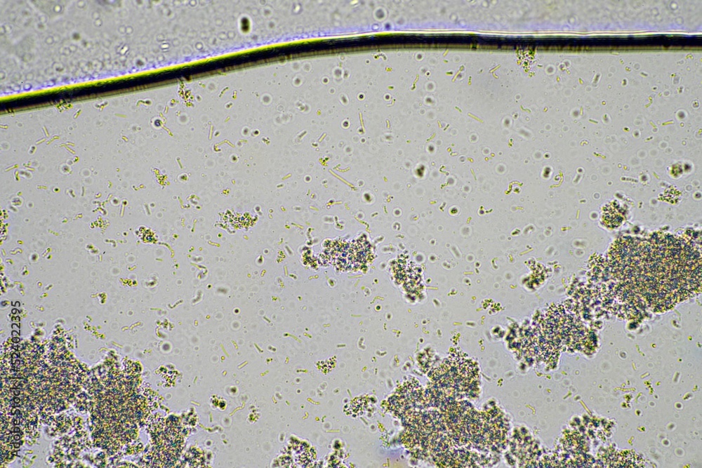 Yogurt under the microscope. Looking at lactobacillus bacteria in a