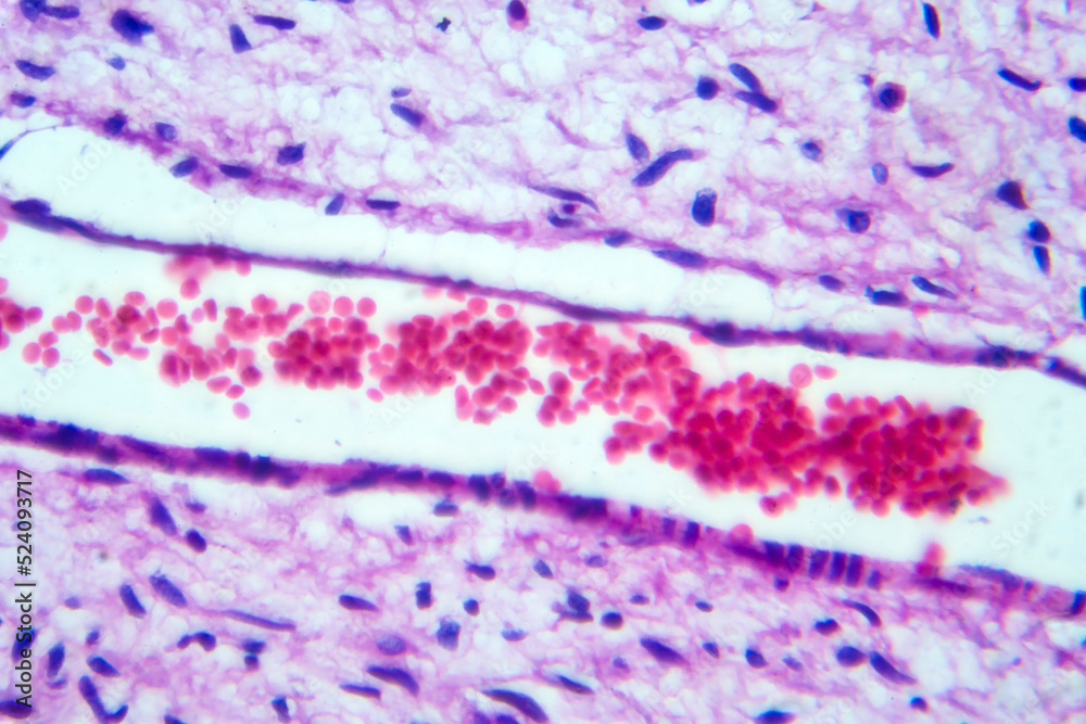 Blood vessel with red blood cells, light micrograph Blood vessel with red blood cells, light micrograph
