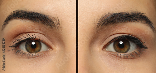 Collage with photos of young woman before and after getting permanent eyeliner makeup, closeup. Banner design