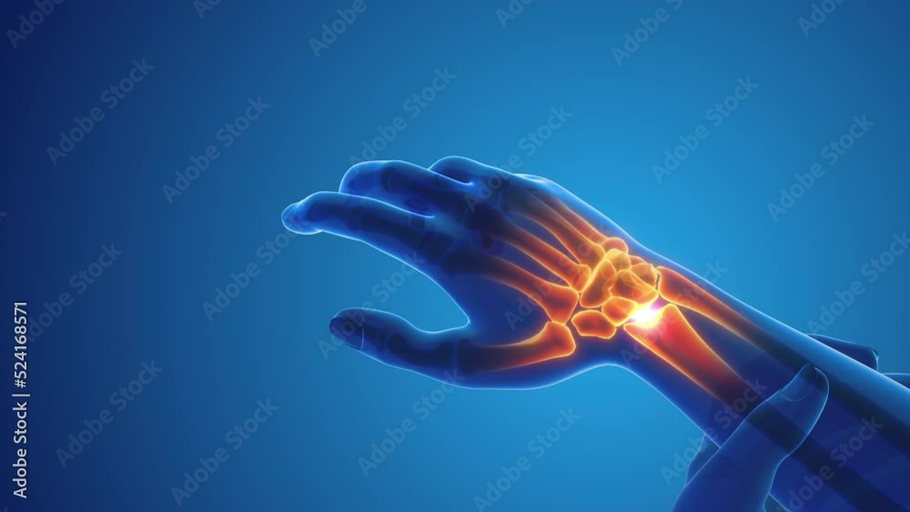 Pain in the wrist joint