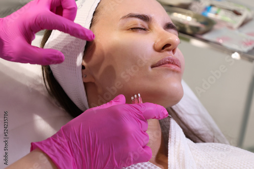 Close up face of thread lifting procedure. Professional cosmetologist in pink medical gloves inserting needles in chin scin. Anti-aging treatment and face lift in cosmetology clinic. Pretty woman fac