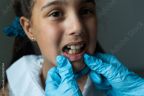 Fototapeta Dentist is check and set dimension of brackets