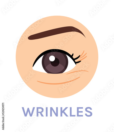 Wrinkles Around the Eye. Skin Problem. Tired Eye. Close up of Eye. Color Cartoon Style. White background. Vector illustration for Beauty and Cosmetic Design.