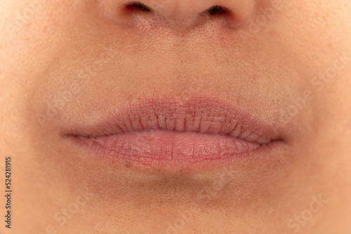 Close-up of female lips on white background before lip augmentation.
