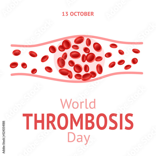 World Thrombosis Day 13 October. Design vector illustration with Thrombosis symbol