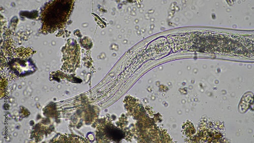 microorganisms and soil biology, with nematodes and fungi under the microscope photo