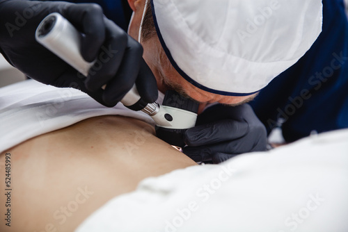 A cosmetologist in a white cap and black gloves examines a mole on the patient's back using a dermatoscope