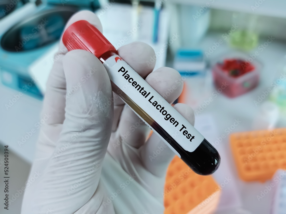 Biochemist of Scientist holds blood sample for Human placental lactogen (hPL) or Human chorionic somatomammotropin (HCS) test. Medical test tube in laboratory background. Biochemist of Scientist holds blood sample for Human placental lactogen (hPL) or Human chorionic somatomammotropin (HCS) test. Medical test tube in laboratory background.