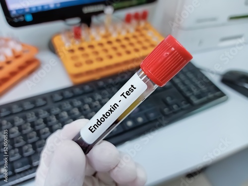 Biochemist of Scientist holds blood sample for Endotoxin test, Limulus amebocyte lysate. Medical test tube in laboratory background.