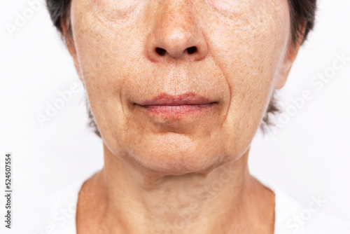 Lower part of elderly woman's face and neck with signs of skin aging isolated on a white background. Age-related changes, flabby sagging facial skin, wrinkles and creases. Cosmetology beauty concept