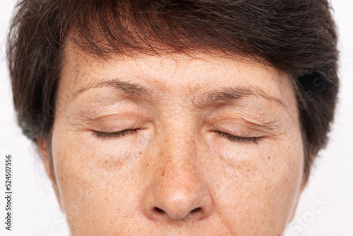 Upper part of elderly woman's face with signs of skin aging isolated on white background. Age-related changes, flabby sagging facial skin, wrinkles and creases on the eyelids and puffiness under eyes photo