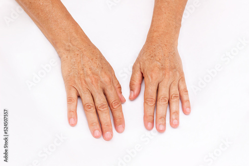 Foto The hands of elderly woman with pigmented spots isolated on a white background