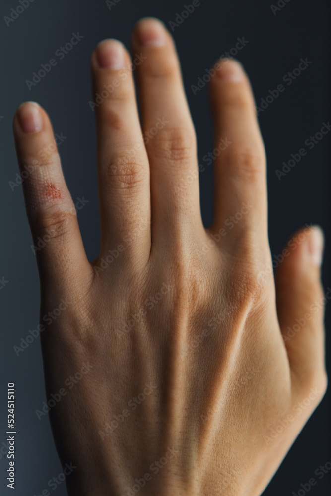 Fototapeta premium A beautiful woman's palm with a wounded finger