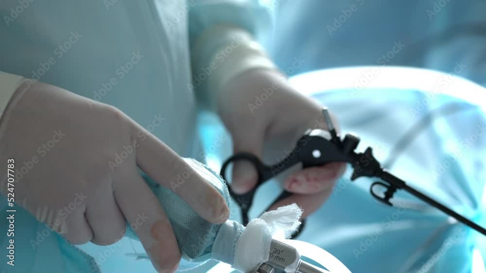 Hands of surgeons with the help of endoscopic equipment and instruments