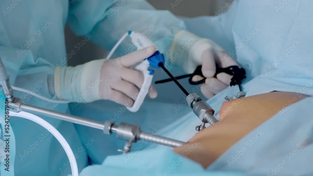 Hands of surgeons with the help of endoscopic equipment and instruments