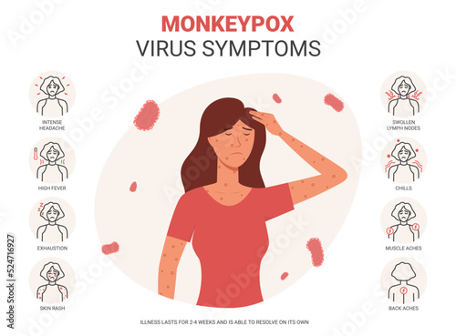 Banner with monkeypox virus symptoms. Concept of monkeypox virus Symptom infographics. A new zoonotic virus from Poxviridae family are reported in Europe and USA. Vector illustration.