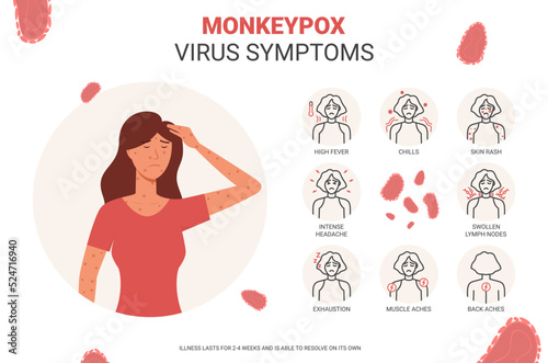 Banner with monkeypox virus symptoms. Concept of monkeypox virus Symptom infographics. A new zoonotic virus from Poxviridae family are reported in Europe and USA. Vector illustration.