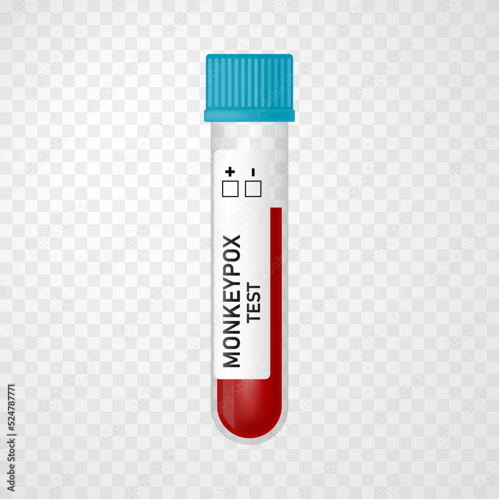 Blood sample tube with Monkeypox virus test on transparent background. Vector realistic illustration. Design for medical banner, flyer, card, infographic Blood sample tube with Monkeypox virus test on transparent background. Vector realistic illustration. Design for medical banner, flyer, card, infographic