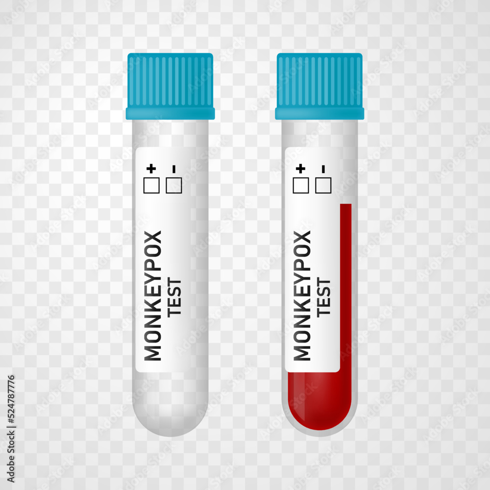 Set of empty tube and blood sample tube with Monkeypox virus test isolated on transparent background. Vector realistic illustration. Design for medical banner, flyer, card, infographic Set of empty tube and blood sample tube with Monkeypox virus test isolated on transparent background. Vector realistic illustration. Design for medical banner, flyer, card, infographic