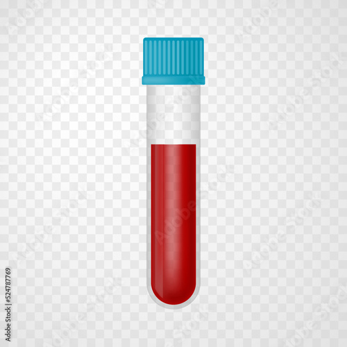 Blood sample tube virus test on transparent background. Vector realistic illustration. Design for medical banner, flyer, card, infographic