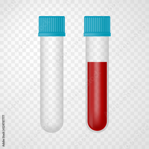 Set of empty tube and blood sample tube test isolated on transparent background. Vector realistic illustration. Design for medical banner, flyer, card, infographic