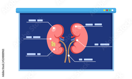 kidney Diagram with explaining. explain anatomy for lecture, workshop, presentation. education concept.