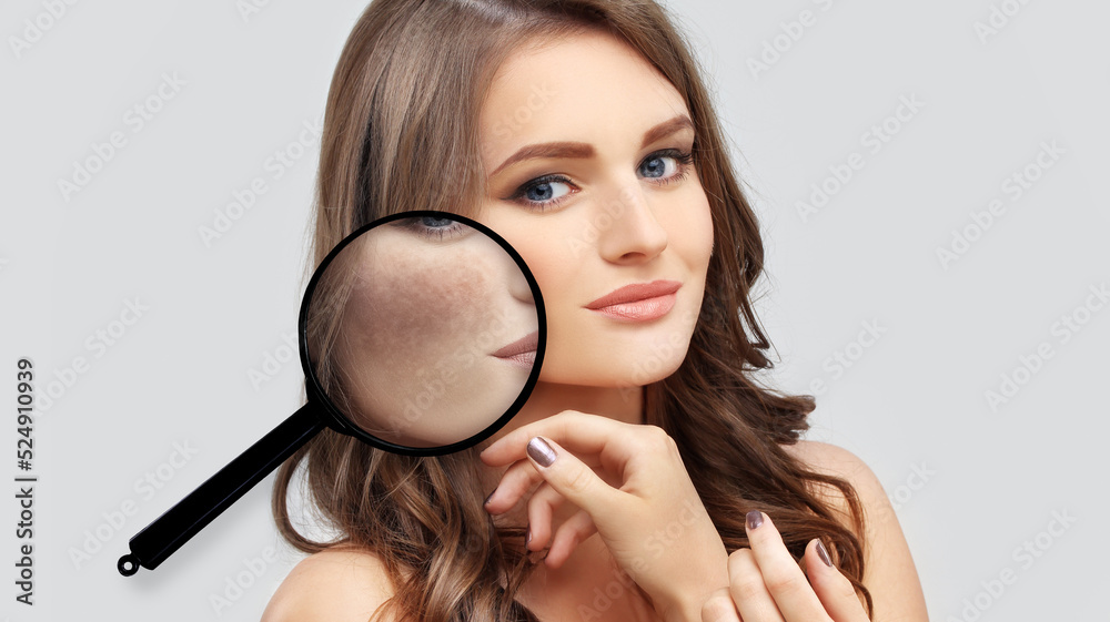 Dark spots, freckles,hyperpigmentation(melasma or chloasma). Dark spots, freckles,hyperpigmentation(melasma or chloasma).
