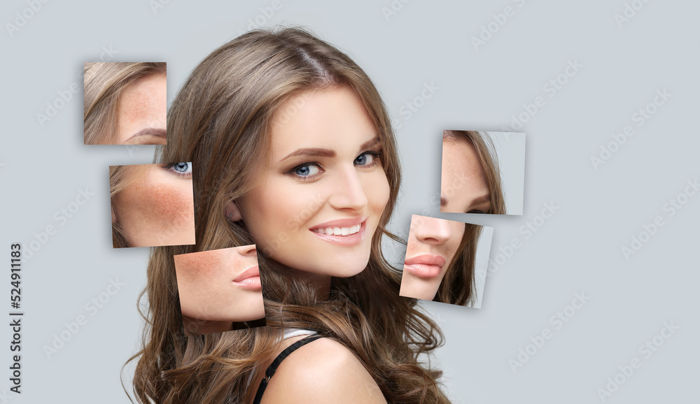 Naklejka premium Dark spots, freckles,hyperpigmentation(melasma or chloasma).