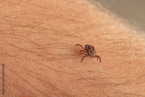 close-up deer tick trying to bite through human skin. Danger Infection through the bite of a dangerous insect that causes Borrelia disease. © Дмитрий Соколов