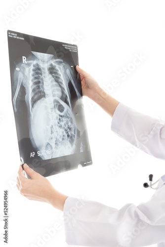 doctor looking baby patient film, treatment consultation, body x-ray, supine position, bowel ileus