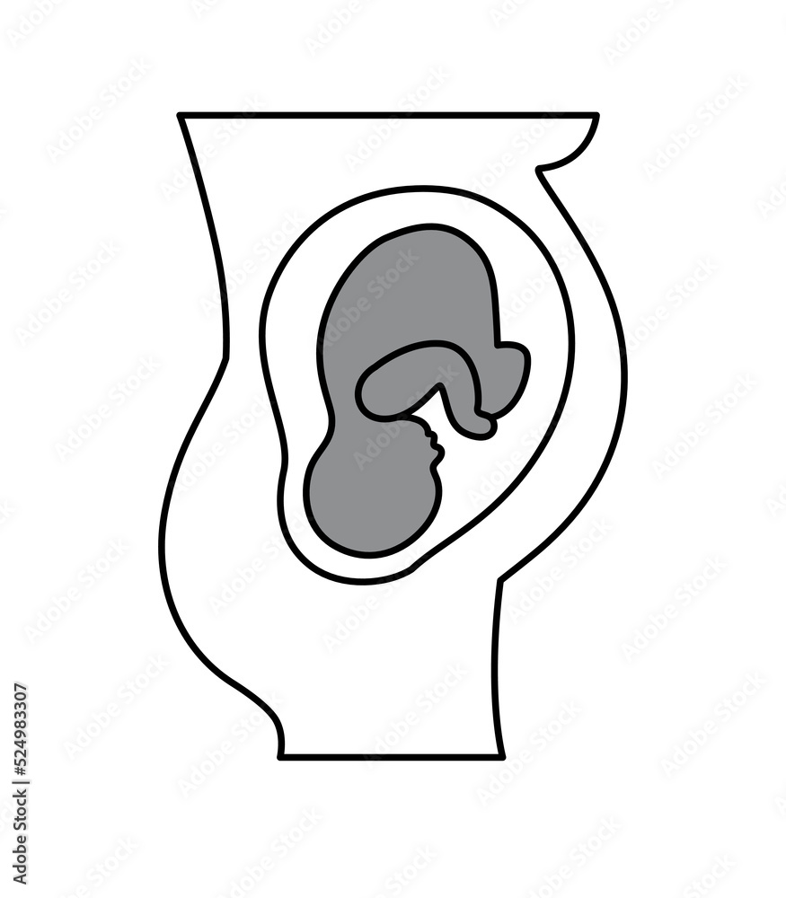 Placental previa. Fetus in Uterus During Pregnancy. Pregnancy women