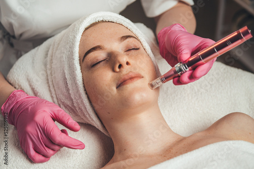 Woman getting facial treatment of chin zone with derma pen at spa salon. Skin treatment. Medicine medical health. Beauty skin. Woman beauty face.