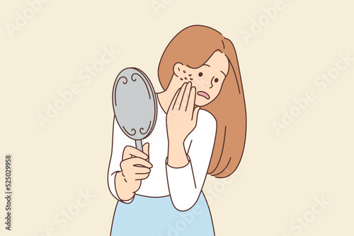 Stressed woman worried about acne 