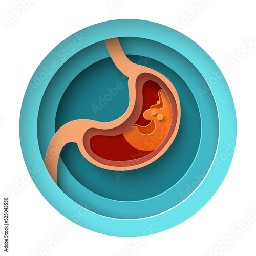 Stomach paper cut vector digestive disease poster