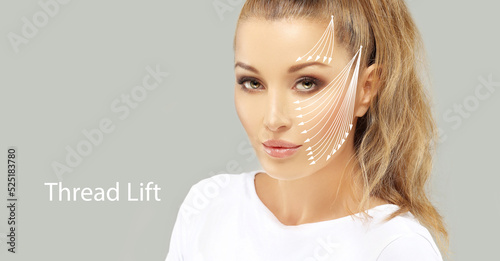 Obraz na plátně Thread Lift ,markup, thread-lift procedure for facial rejuvenation