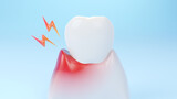 Gums gum inflammation, gingival recession. Dental treatment concept. 3D rendering.