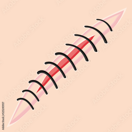 Scar suture flat vector illustration