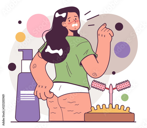 Young woman with cellulite on her thighs. Girl in underwear with skin