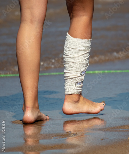 The girl's bandaged leg is on the shore by the sea.
