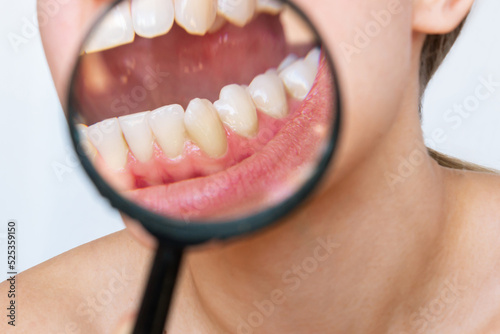 Fotografia Young woman's teeth with tartar enlarged in a magnifying glass isolated on a white background