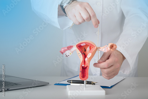 Gynecologist shows how to ligate the fallopian tubes on training model of female reproductive system photo