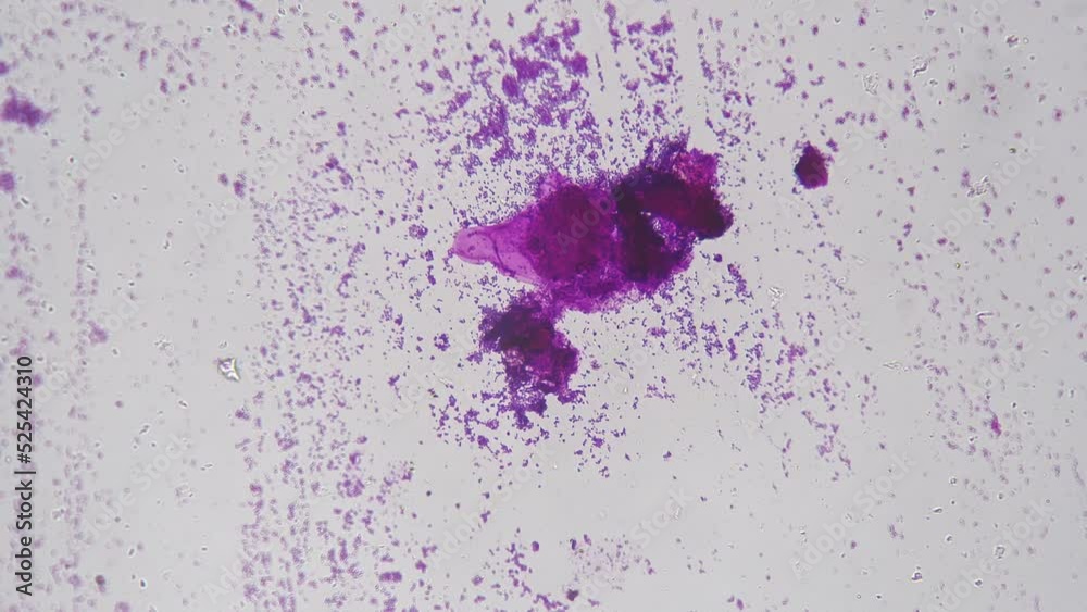 Three types of bacteria are filmed under microscope against bright