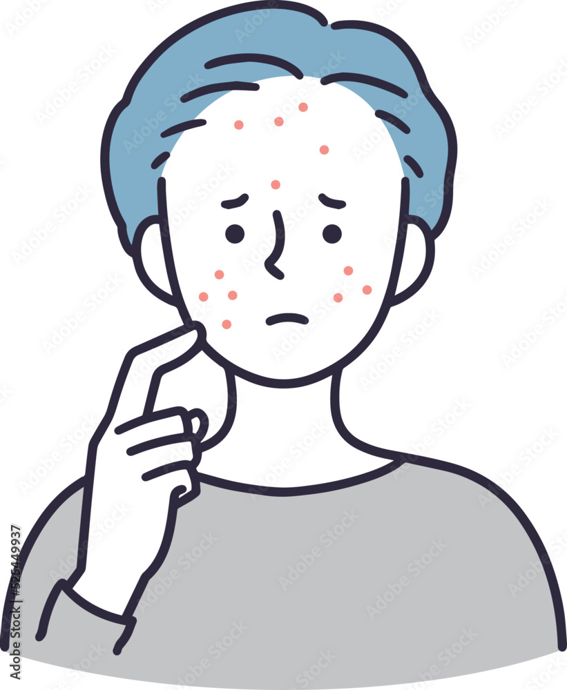 ニキビで悩む男性 シンプルイラスト ニキビで悩む男性 シンプルイラスト