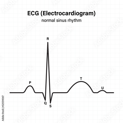 Diagram showing normal heart beat wave. Electrocardiogram of normal sinus rhythm. Vector for medical science and education use.