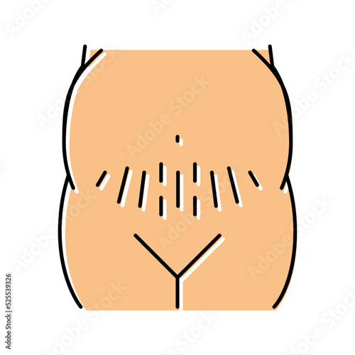 pregnancy stretch marks color icon vector illustration