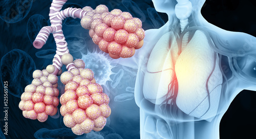 Photos Alveoli in lungs