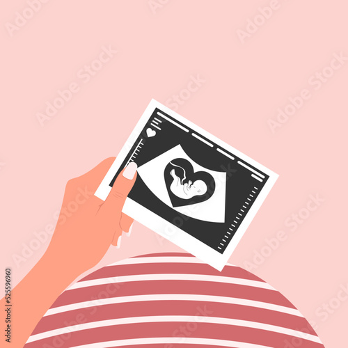A happy pregnant woman holds a picture of a fetal ultrasound scan. An ultrasound picture of the baby. Vector