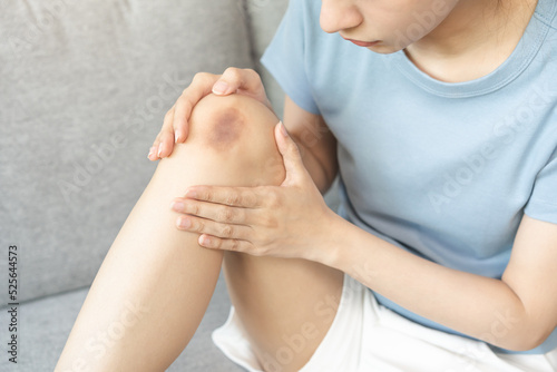 Close up of stain bruise wound on leg  contusion asian young woman  girl on joint knee from an accident fell down  hand in healing injury by massage hematoma blood. Extravasation blue  purple on skin.